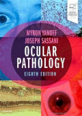 Ocular pathology