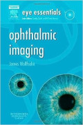 Ophthalmic Imaging